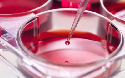 Un nou studiu promițător deschide o cale inovatoare pentru tratamentul leucemiei mieloide acute, o formă de cancer hematologic cu rate de mortalitate ridicate