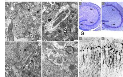 Experimente recente: Se poate reînvia un creier crioconservat?