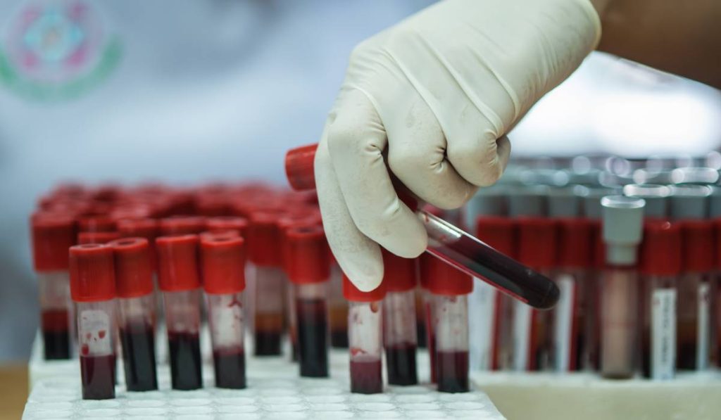 Detectarea timpurie a bolilor – când și ce analize medicale trebuie să faci la 25, 35 și 45 de ani Pe măsură ce îmbătrânim, ne conștientizăm mai mult importanța controlului regulat al sănătății