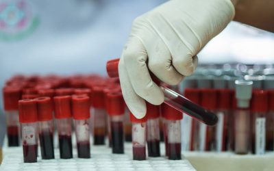 Detectarea timpurie a bolilor – când și ce analize medicale trebuie să faci la 25, 35 și 45 de ani Pe măsură ce îmbătrânim, ne conștientizăm mai mult importanța controlului regulat al sănătății