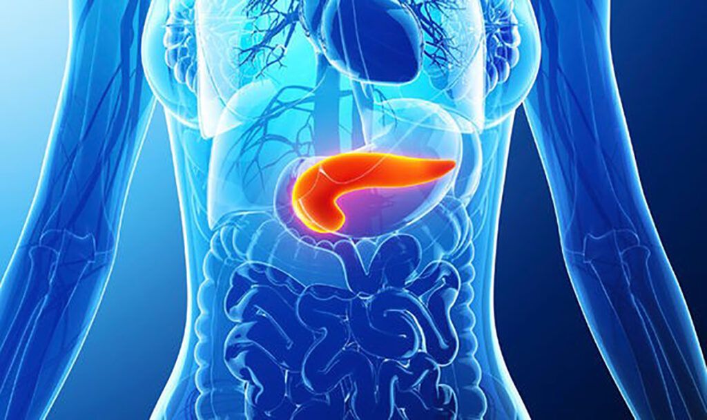 Descoperire revoluționară în lupta împotriva cancerului pancreatic: mecanismul ascuns al rezistenței la chimioterapie Cancerul pancreatic continuă să fie unul dintre cele mai agresive și letale tipuri de cancer, cu rate de supraviețuire extrem de scăzute și tratamente dificil de eficientizat