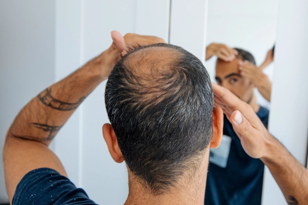 O descoperire revoluționară în regenerarea foliculilor de păr could usa calea către tratamente eficiente pentru chelie Cercetările din domeniul medicinei regenerative au făcut un salt important odată cu identificarea unei configurații celulare esențiale pentru reconstrucția funcțională a foliculilor de păr