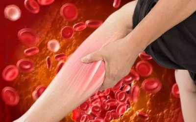 Colesterolul LDL ridicat, adesea numit și “colesterol rău”, reprezintă o amenințare tăcută pentru sănătate, fiind frecvent subestimat de către cei afectați