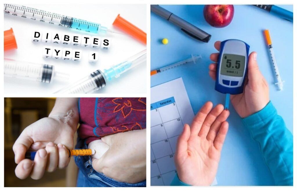Un tratament revoluționar cu celule stem promite vindecarea diabetului de tip 1 O veste extrem de promițătoare pentru milioanele de oameni afectați de diabetul de tip 1 a ieșit la iveală din cercetările recente