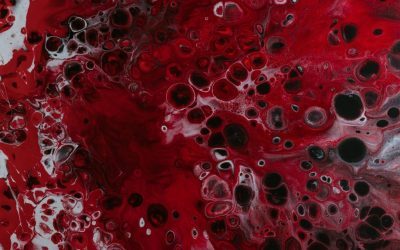Anemia feriprivă, cea mai frecventă formă de anemie întâlnită în rândul populației globale, reprezintă o problemă de sănătate ce afectează milioane de oameni, chiar și în țările dezvoltate