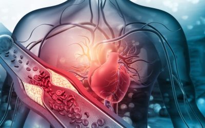 Atenție: Alimentul-minune care „curăță” arterele și previne AVC-ul, dezvăluit de medic