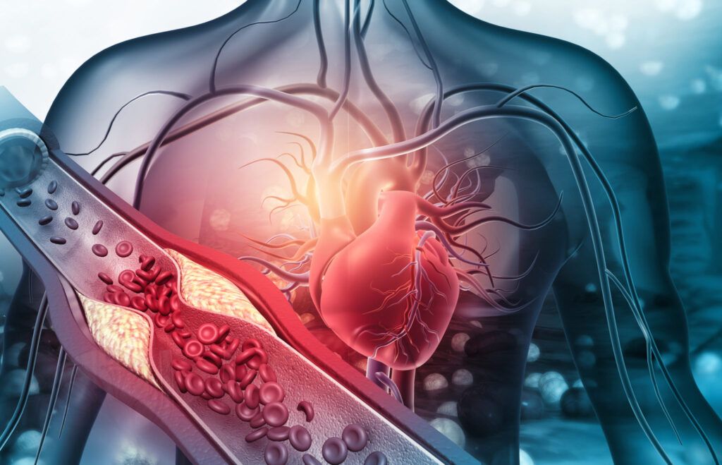 Atenție: Alimentul-minune care „curăță” arterele și previne AVC-ul, dezvăluit de medic