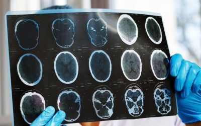 Organizațiile de pacienți cer intervenția urgentă a autorităților în urma scăderii semnificative a monitorizării pacienților cronici Numărul investigațiilor de monitorizare de înaltă performanță pentru pacienții cronici a înregistrat o reducere de aproximativ 47% într-o singură lună, după aplicarea noilor reguli de decontare de la începutul anului