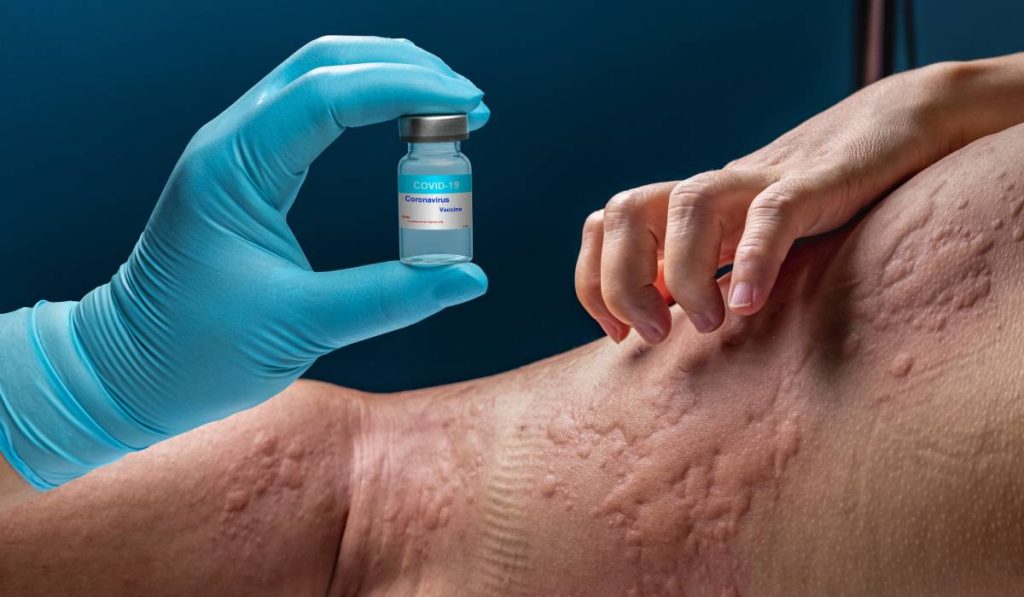 O tânără din România, diagnosticată cu peste 40 de alergii, a reușit să își îmbunătățească semnificativ calitatea vieții după un tratament special pentru astm