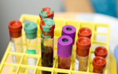 Cât scoți din buzunar în 2026 pentru analize medicale: diferența e uriașă