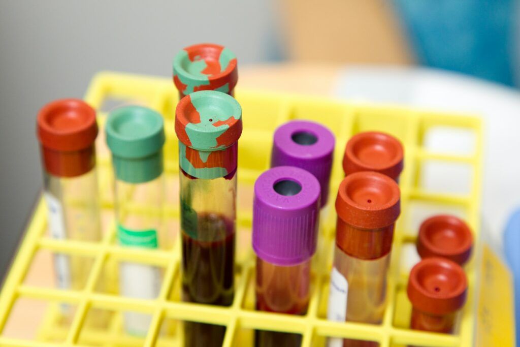 Cât scoți din buzunar în 2026 pentru analize medicale: diferența e uriașă