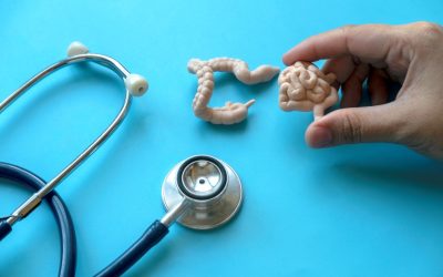 Cancer de colon: Tineri în pericol. Ce se întâmplă la nivel global?