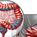 Mâncarea banală ce ucide: Crește riscul de cancer, avertizează specialiștii din România