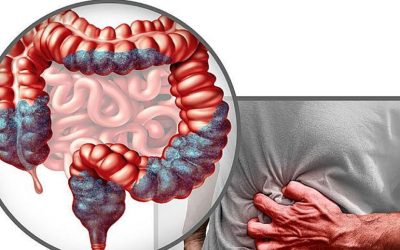 Aproape jumătate dintre adulți nu sunt conștienți de legătura dintre consumul anumitor alimente și riscul de cancer colorectal, conform datelor recente