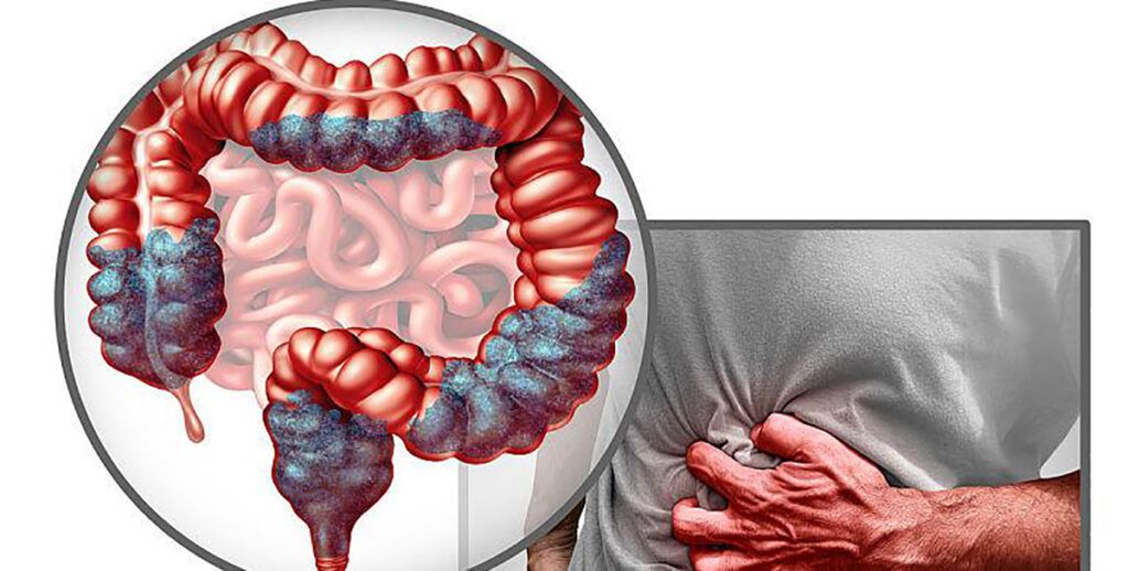 Mâncarea banală ce ucide: Crește riscul de cancer, avertizează specialiștii din România