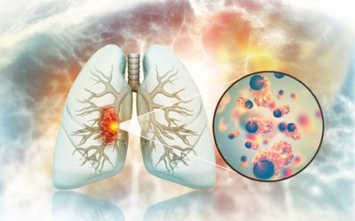 Creștere alarmantă: Cancer pulmonar la nefumători, motivele șochează medicii!