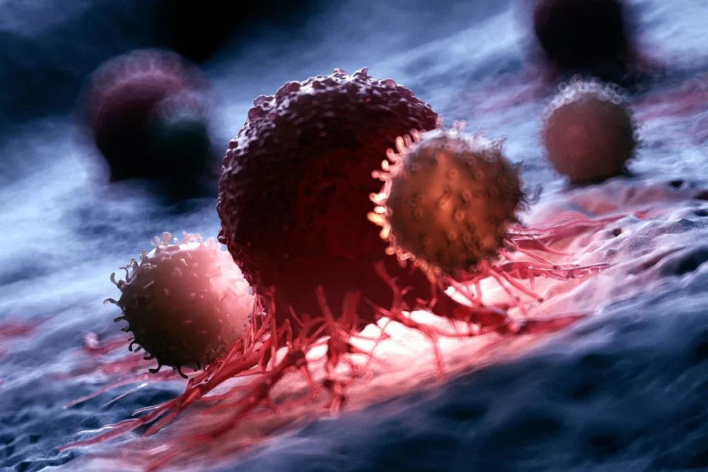 Imunoterapia învinge cancerul: „Pare science fiction”, spune expertul