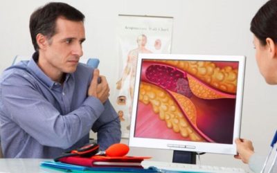 Cardiologii americani lansează ghiduri noi pentru managementul colesterolului și prevenirea infarctului și AVC