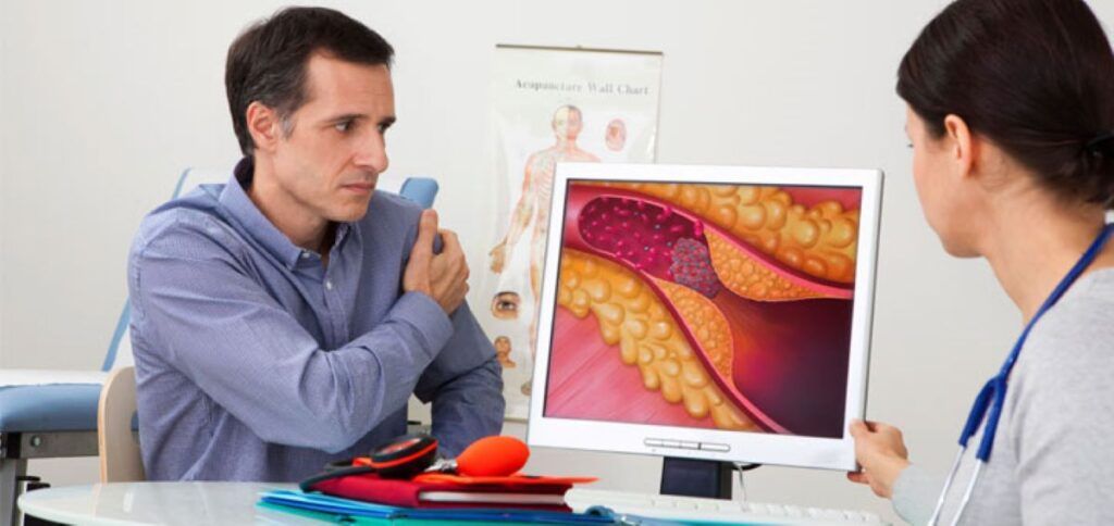 Cardiologii americani lansează ghiduri noi pentru managementul colesterolului și prevenirea infarctului și AVC