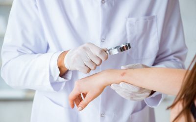 Ectima: Cauze, simptome și tratamente eficiente pentru o afecțiune des întâlnită