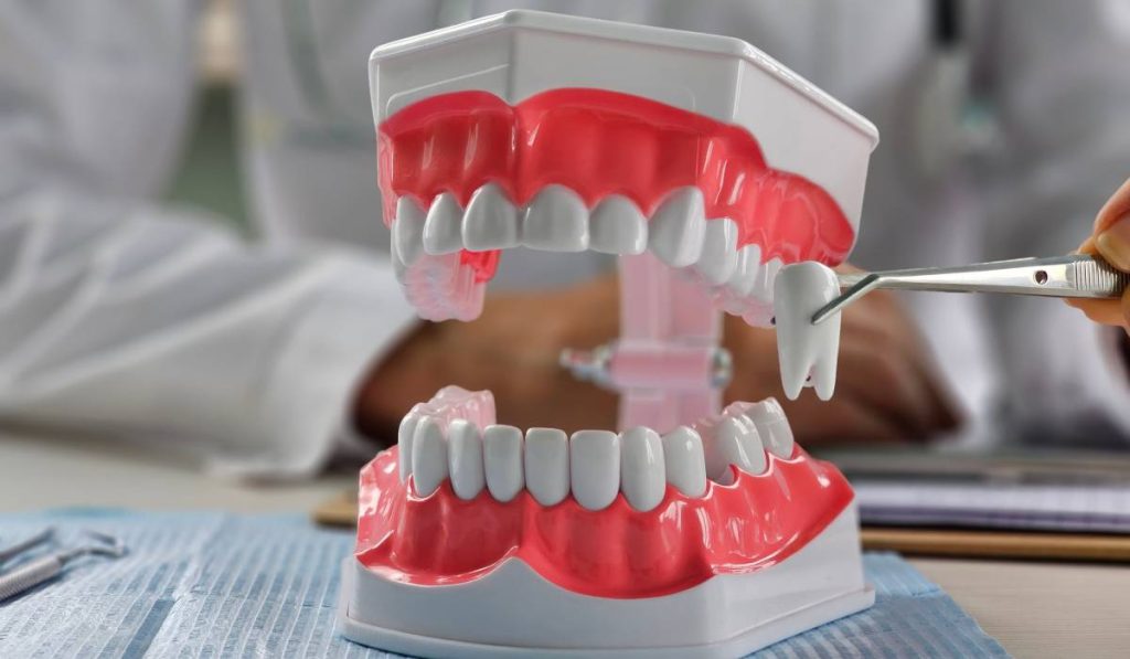 Extracție dentară sau nu? Ortodontiștii dezbat. Ce spun specialiștii