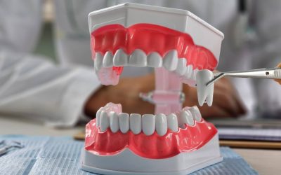 Extracție dentară sau nu? Ortodontiștii dezbat. Ce spun specialiștii