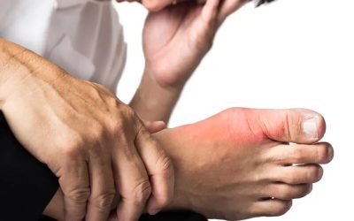 Vitamina-minune: Scade acidul uric și potolește suferința de gută