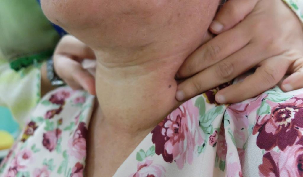 Boala „ascunsă” care te îngrașă: Dieta nu mai contează