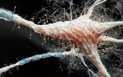 Inflamația intestinală, nou factor în scleroza multiplă