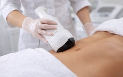 Liposucția nechirurgicală Liposonix devine realitate clinică Reducerea grăsimii localizate fără bisturiu și anestezie devine o soluție accesibilă și sigură pentru persoanele interesate de conturarea corpului