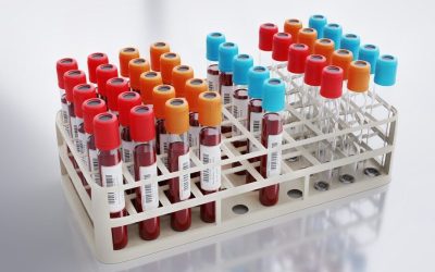 Analiza sângelui: PREZICE riscul de infarct și AVC mai bine ca colesterolul!