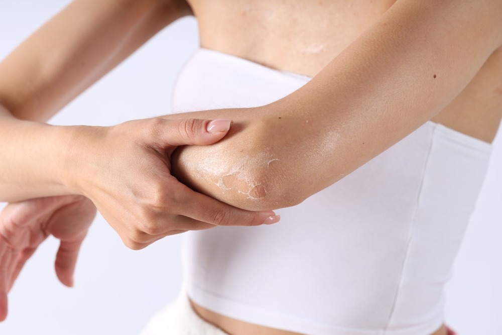 Piele uscată pe brațe și picioare? 5 obiceiuri care o distrug