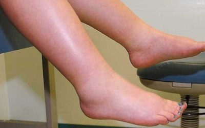 Leguma-minune: Scapă de picioare umflate și îmbunătățește circulația!