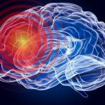 O boală neurologică, necunoscută până acum, a fost descoperită