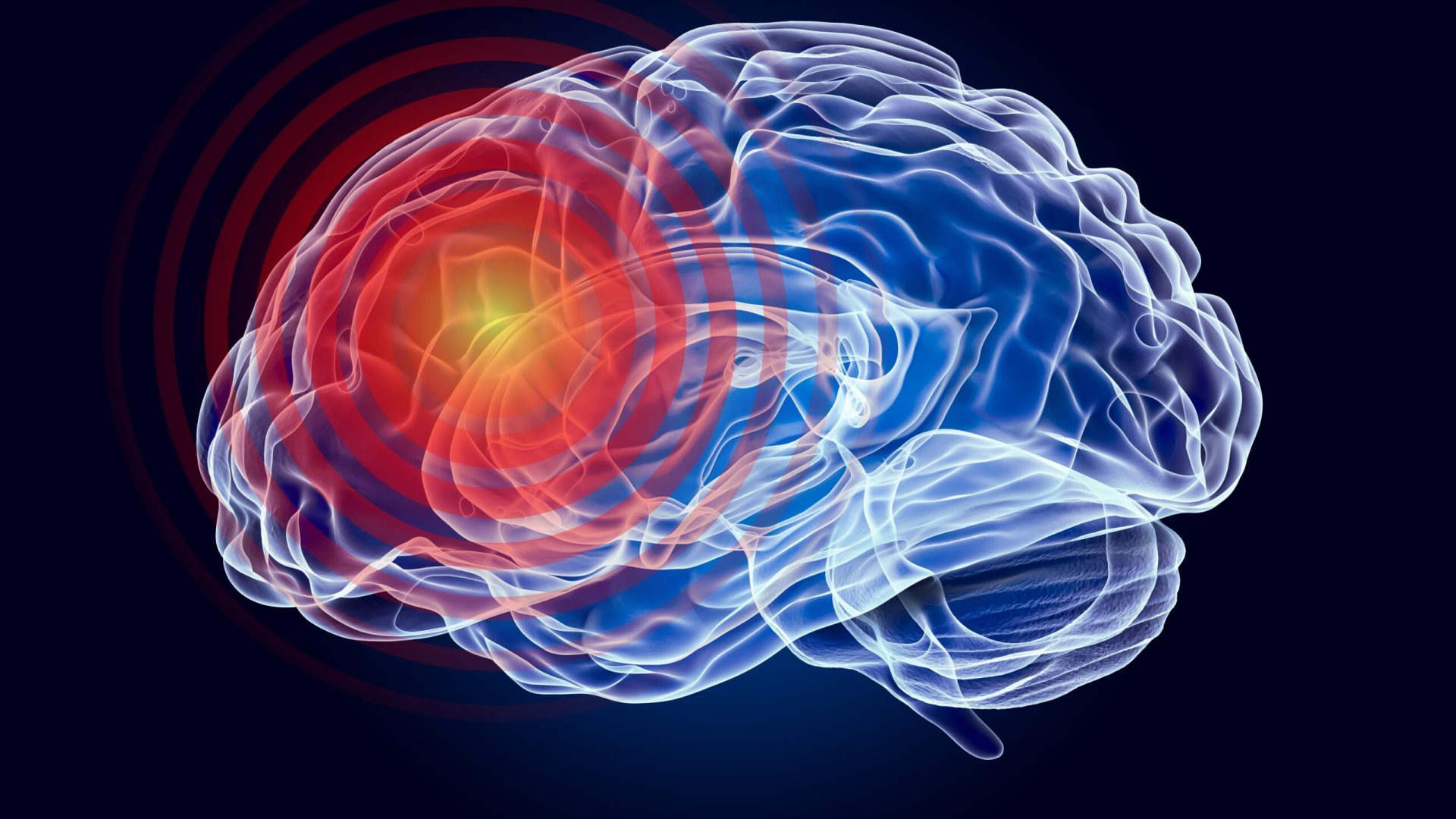 Oamenii de știință au descoperit o nouă tulburare de dezvoltare neurologică, cu potențial impact asupra a mii de copii și familii din întreaga lume