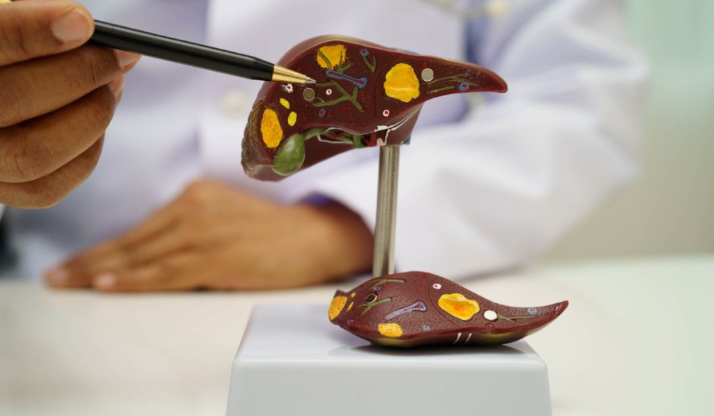 Boala ficatului gras: Atentie la acest “simptom”, avertizează medicii