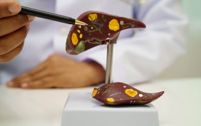 Boala ficatului gras: Atentie la acest “simptom”, avertizează medicii