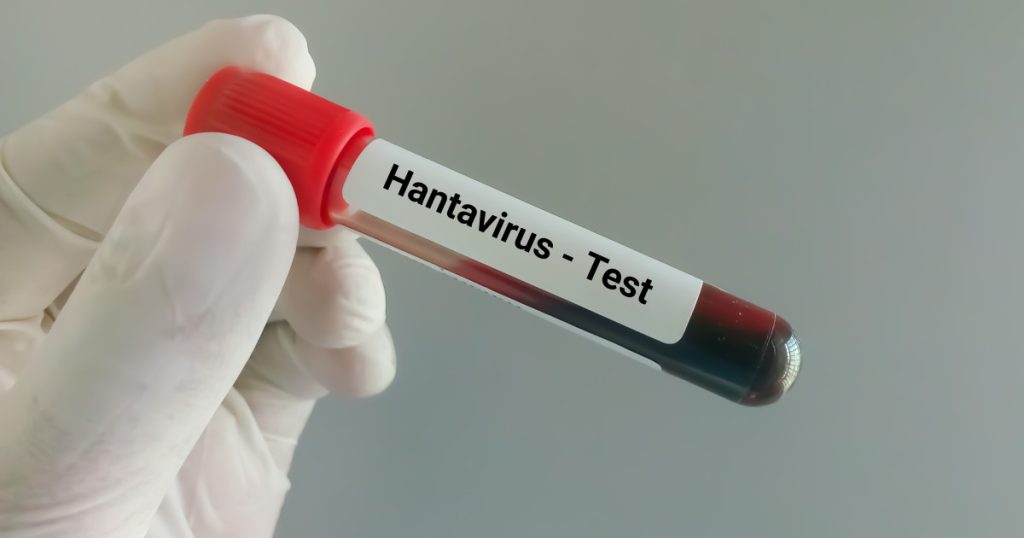 Hantavirus: Pompier de la ISU Caraș-Severin, suspect de infecție după ce a fost în Serbia