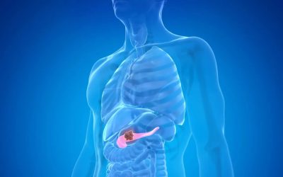 Model revoluționar în oncologie: O nouă speranță pentru pacienți