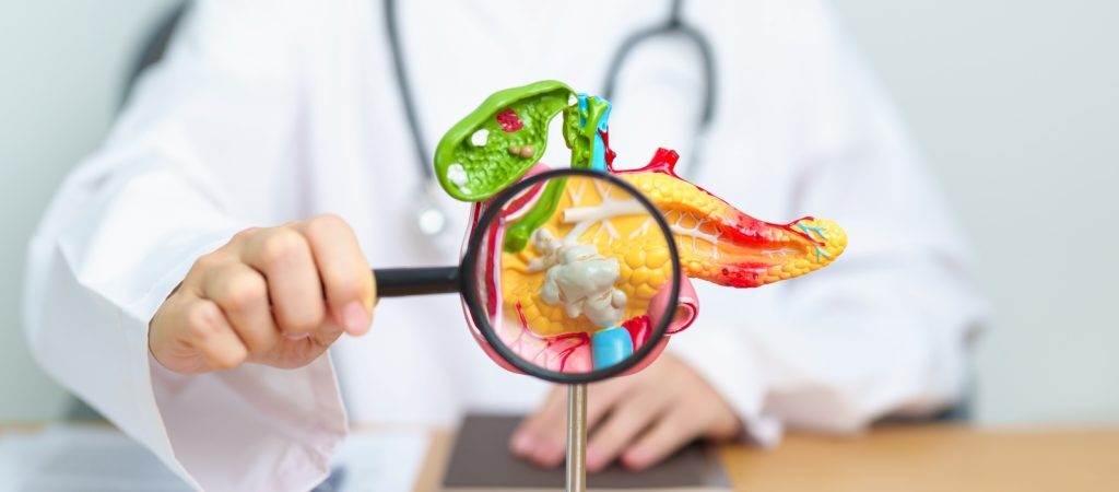 O bere/zi, risc cancer pancreatic? Ce spun medicii
