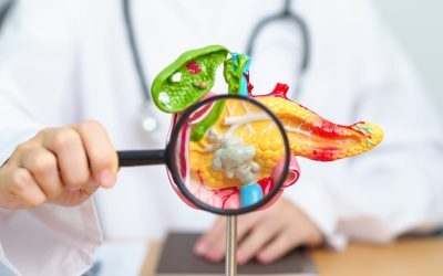 O bere/zi, risc cancer pancreatic? Ce spun medicii