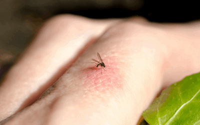 Curtea fără dăunători: Specialiștii, soluții naturale anti-viespi și țânțari