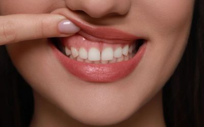 Leziunea bucală: Mai mult decât o problemă estetică, un semn de boală