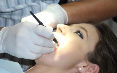 Prețuri dentare România: Timișoara, cea mai ieftină. Cât costă implantul