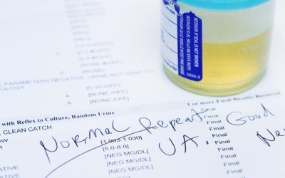 Test de urină: Detectează 9 din 10 cazuri de cancer de vezică